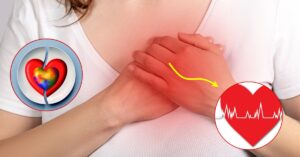 Quali sono le malattie cardiache più comuni tra le donne? Cause e sintomi