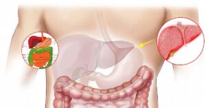 Sintomi fegato malato: gli “indizi” che qualcosa non va
