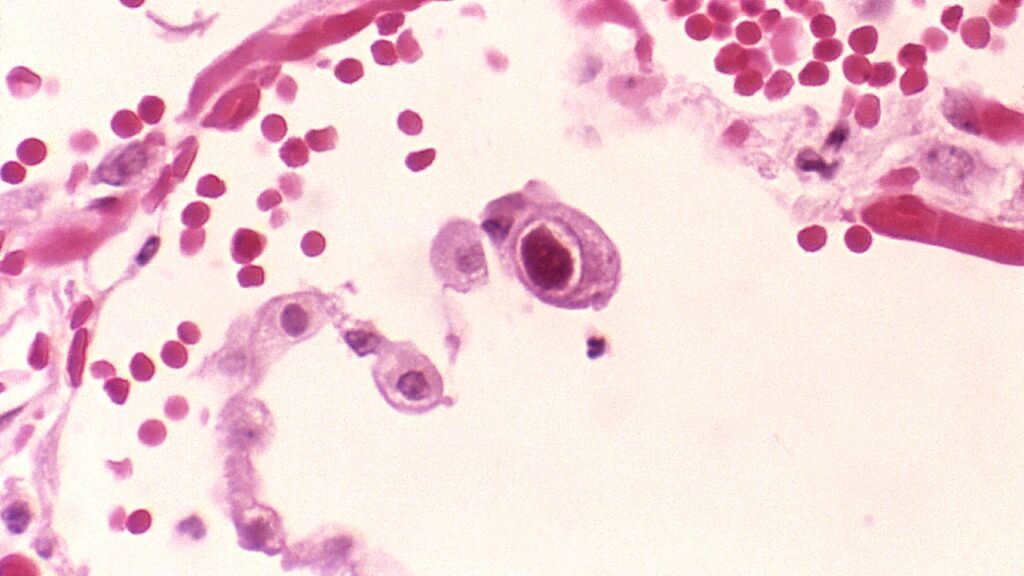 citomegalovirus in laboratorio