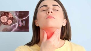 Quali sono i sintomi del tumore alla tiroide e perché è in aumento tra i giovani