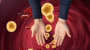 Viso, mani e gambe: quali sono i segni del colesterolo alto e come riconoscerli
