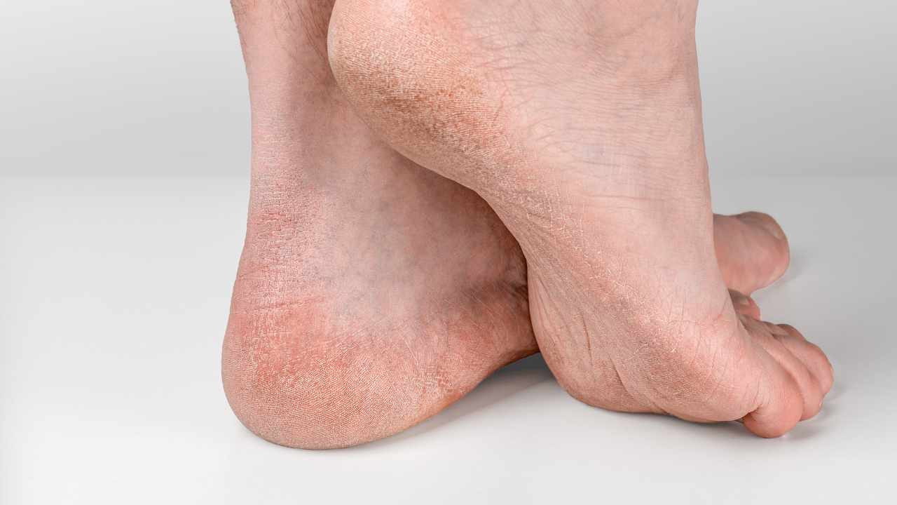 piedi
