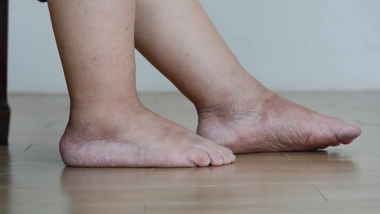 piedi