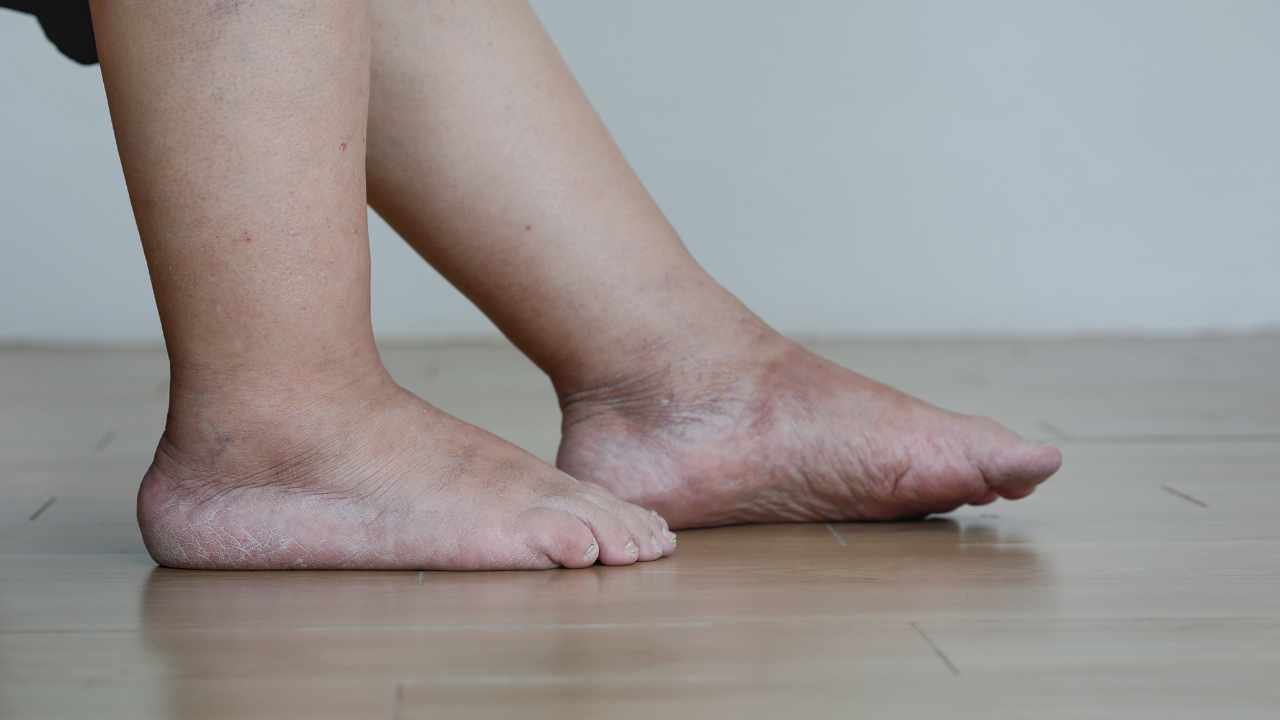 piedi